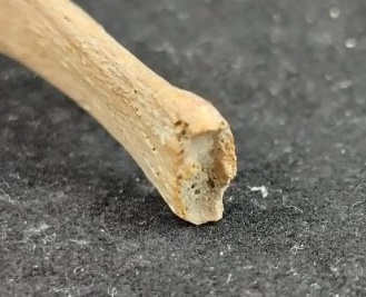 Bordák a bordaporc felé néző végrészeik öregedési stádiumai – fenti kép bordái közül 4 közelebbről - 2