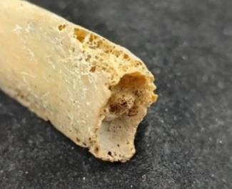 Bordák a bordaporc felé néző végrészeik öregedési stádiumai – fenti kép bordái közül 4 közelebbről - 3