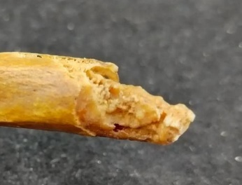 Bordák a bordaporc felé néző végrészeik öregedési stádiumai – fenti kép bordái közül 4 közelebbről - 4