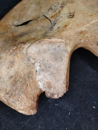 Facies auricularis öregedési stádiumainak morfológiai és szerkezeti jellemzői (Buckberry és Chamberlain 2002)