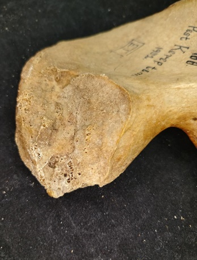 Facies auricularis öregedési stádiumainak morfológiai és szerkezeti jellemzői (Buckberry és Chamberlain 2002)