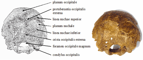 Nyakszirtcsont hátulnézetben