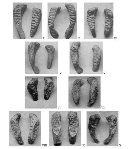 A facies symphysialis ossis pubis életkori stádiumai Todd (1920) szerint.