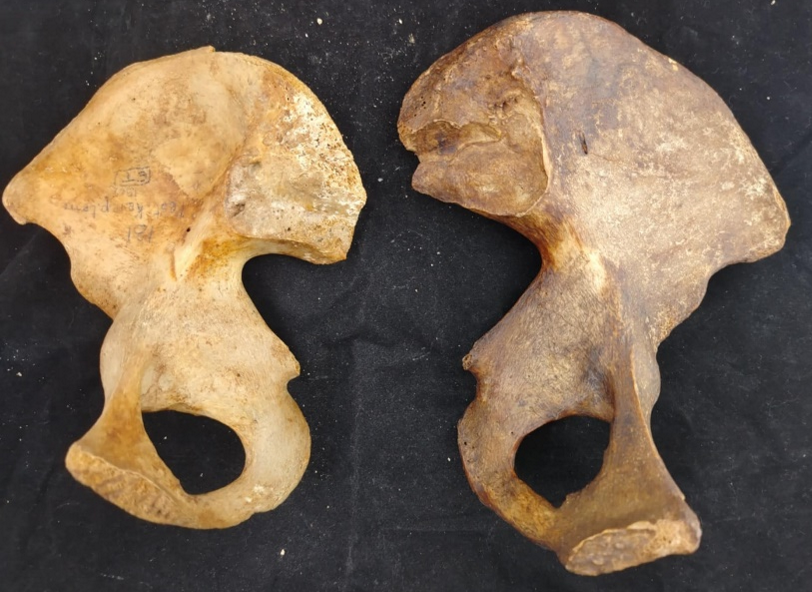 Incisura ischiadica major egy férfias (bal oldali csont a képen) és egy nőies (jobb oldali csont a képen) medencecsont esetében